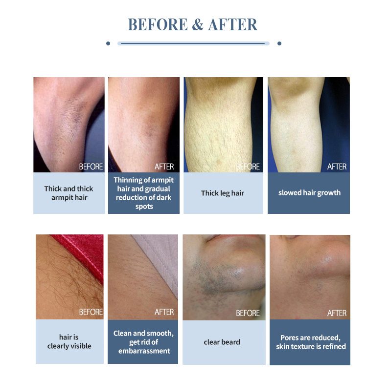 Before and after references